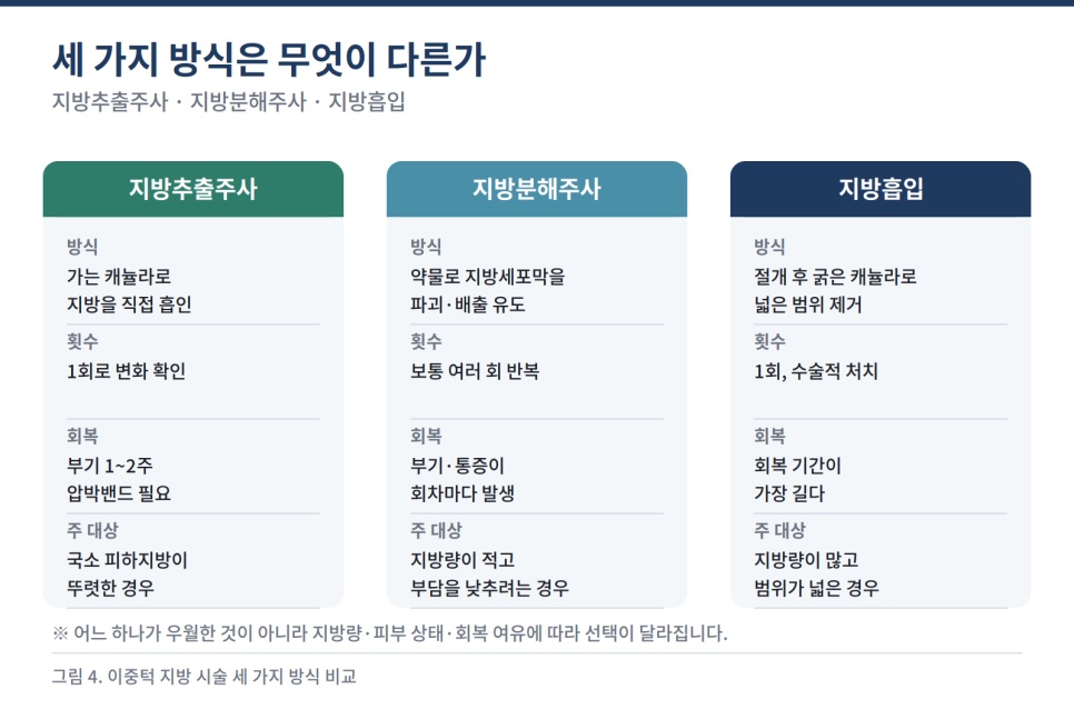 세 가지 방식 비교